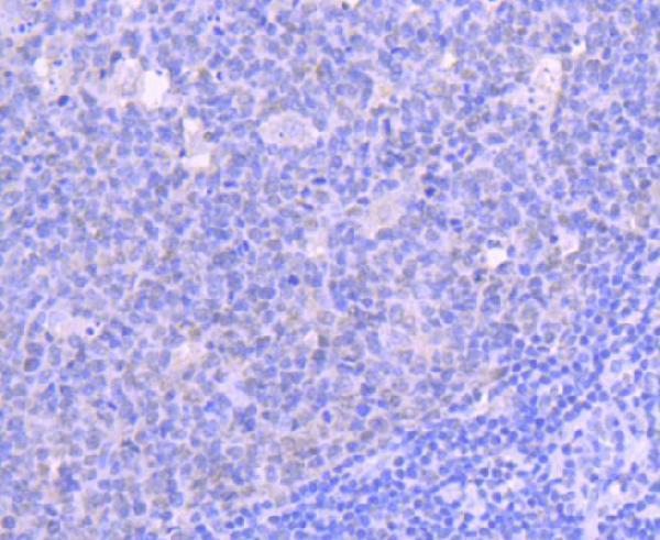 Immunohistochemical analysis of paraffin-embedded human tonsil tissue using anti-HDAC1 antibody