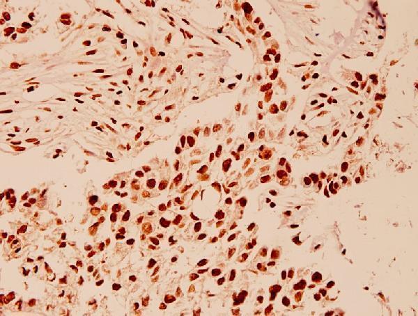 a00256 hdac1 primary antiboties ihc testing 2