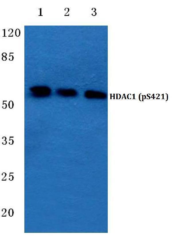 Western blot (WB) analysis of p-HDAC1 (S421) polyclonal antibody at 1:500 dilution
Lane1:MCF-7 cell lysate treated with EGF(0