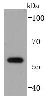 a00257 1 e2f1 primary antiboties wb testing 1