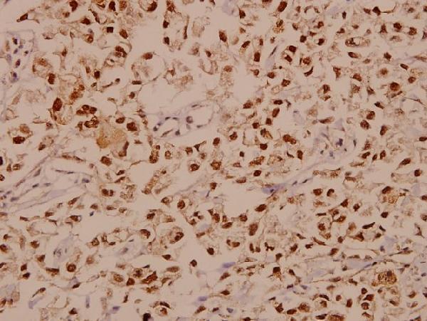 a00257 e2f1 primary antiboties ihc testing 2