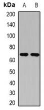 Western blot analysis of Butyrylcholinesterase expression in HEK293T (A), SW620 (B) whole cell lysates
