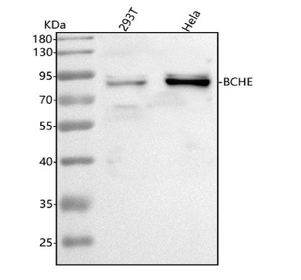 Western blot analysis of BCHE using anti-BCHE antibody (A00258-2)