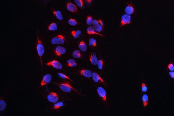 a00259 1 cars primary antibodies if testing 2