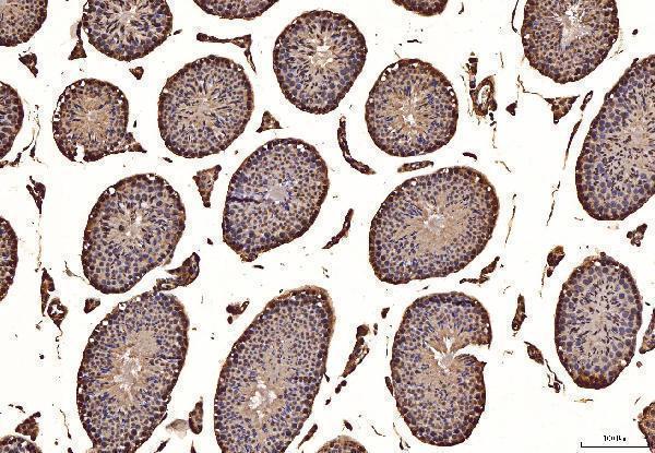 a00261 1 tbk1 primary antibodies ihc testing 2
