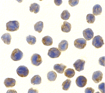 a00261 tbk1 primary antibodies icc testing 1