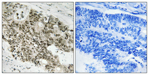a00262 1 atr primary antibodyes ihc testing 2