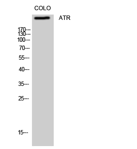a00262 1 atr primary antibodyes wb testing 1