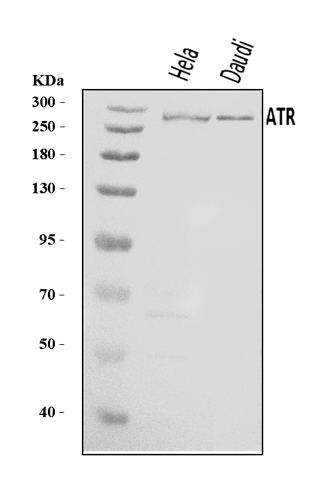  Western blot analysis of ATR using anti-ATR antibody (A00262-3)