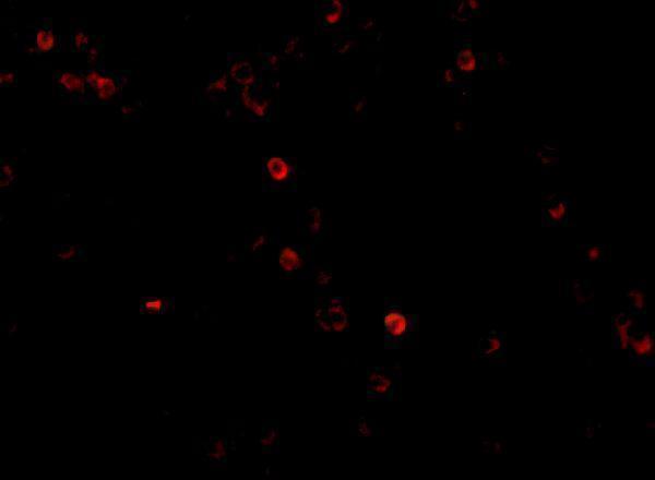 Immunofluorescence of MDA5 in Human Lymph Node cells with MDA5 antibody at 20 ug/mL