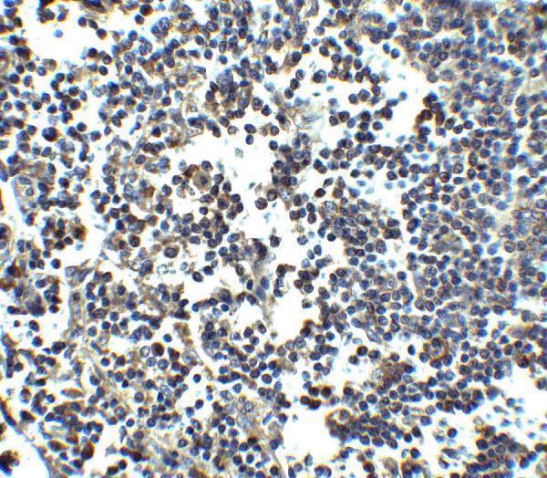Immunohistochemistry of MDA5 in human lymph node tissue with MDA5 antibody at 2