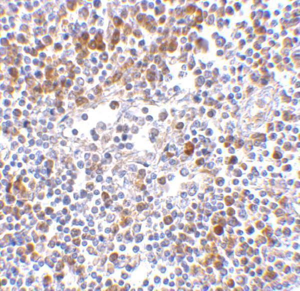 a00263 ifih1 primary antibodies ihc testing 4