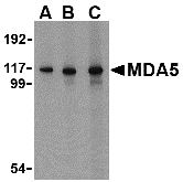 Western blot analysis of MDA5 in Daudi cell lysate with MDA5 antibody at (A) 1, (B) 2 and (C) 4 μg/mL