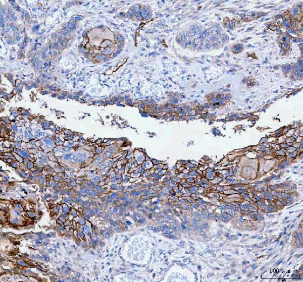  IHC analysis of PALM using anti-PALM antibody (A00265-1)