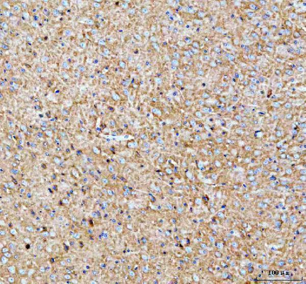 a00265 1 palm primary antibodies ihc testing 4