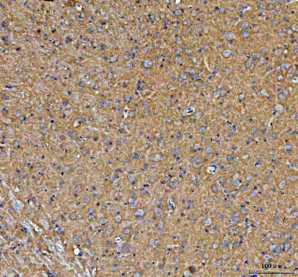 a00265 1 palm primary antibodies ihc testing 5