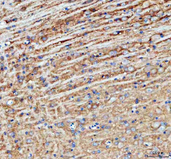 a00265 1 palm primary antibodies ihc testing 6