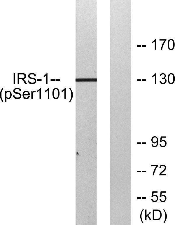 Western blot analysis of lysates from COS7 cells treated with Calyculin A 50ng/ml 30