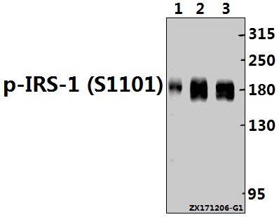 Western blot (WB) analysis of p-IRS-1 (S1101) pAb at 1:500 dilution
Lane1:A375 whole cell lysate(40ug)
Lane2:Panc1 whole cell lysate(40ug)
Lane3:MCF-7 whole cell lysate(40ug)