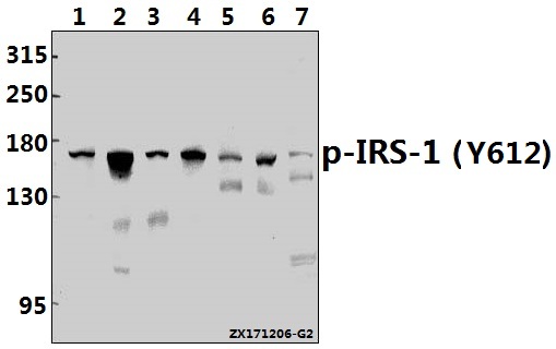 Western blot (WB) analysis of p-IRS-1 (Y612) pAb at 1:500 dilution
Lane1:MCF-7 whole cell lysate(40ug)
Lane2:HEK293T whole cell lysate(40ug)
Lane3:A375 whole cell lysate(40ug)
Lane4:A2780 whole cell lysate(40ug)
Lane5:Hela whole cell lysate(40ug)
Lane6:C6 whole cell lysate(40ug)
Lane7:NIH-3T3 whole cell lysate(40ug)