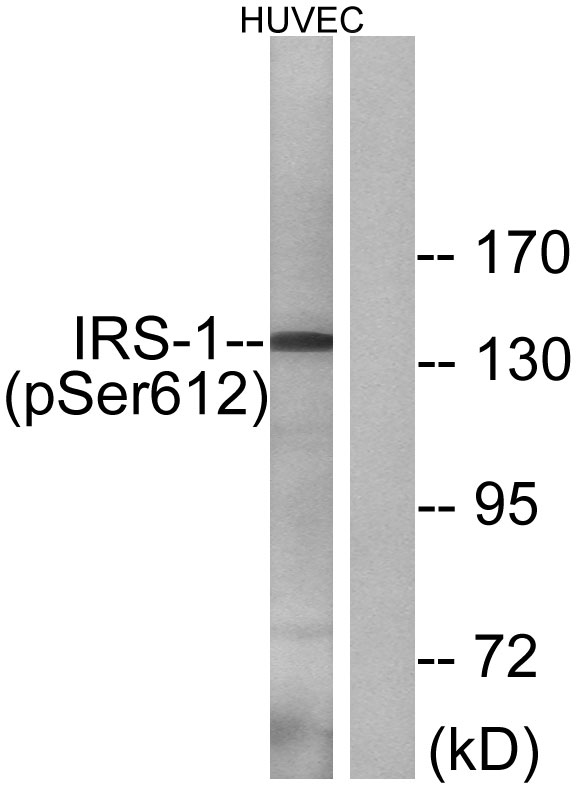 Western blot analysis of lysates from HUVEC cells treated with insulin 0
