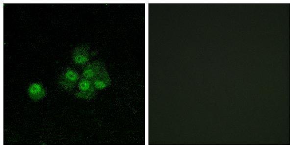 a00268s636 irs1 primary antibodies if testing 6