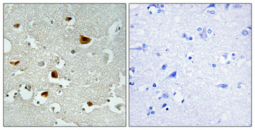 Immunohistochemical analysis of paraffin-embedded Human brain