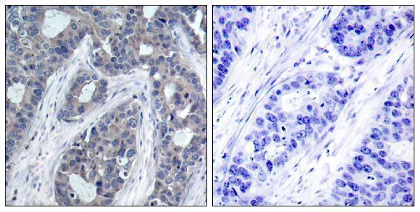 a00268s636 irs1 primary antibodies ihc testing 5