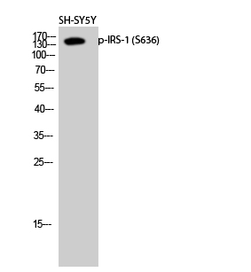 Western Blot analysis of SH-SY5Y cells using Phospho-IRS-1 (S636) Polyclonal Antibody diluted at 1:2000