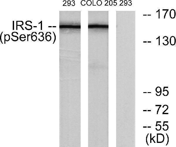 Western blot analysis of lysates from 293 cells and COLO205 cells, using IRS-1 (Phospho-Ser636) Antibody