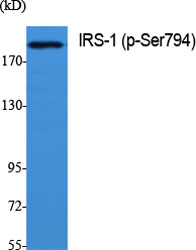 Western Blot analysis of various cells using Phospho-IRS-1 (S794) Polyclonal Antibody diluted at 1:500
