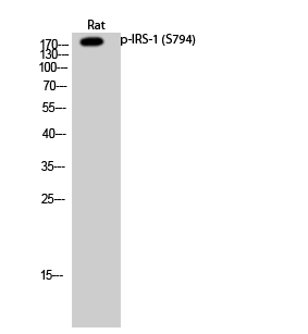 Western Blot analysis of Rat cells using Phospho-IRS-1 (S794) Polyclonal Antibody diluted at 1:500