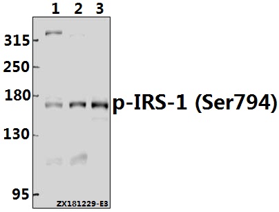 Western blot (WB) analysis of IRS-1 (Phospho-Ser794) polyclonal antibody at 1:500 dilution
Lane1:A375 whole cell lysate(40ug)
Lane2:A2780 whole cell lysate(40ug)
Lane3:HepG2 whole cell lysate(40ug)