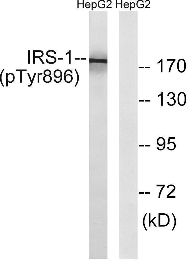 Western blot analysis of lysates from HepG2 cells treated with Na3VO4 0