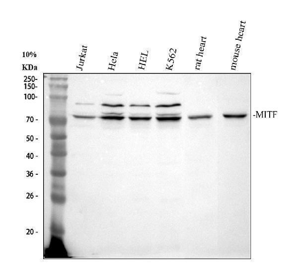  Western blot analysis of MITF using anti-MITF antibody (A00269-3)