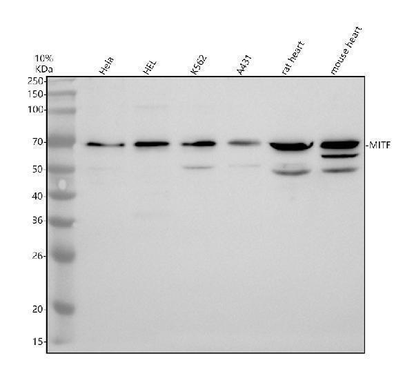 Western blot analysis of MITF using anti-MITF antibody (A00269-3)