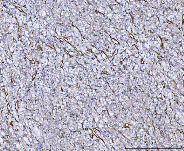  IHC analysis of Von Willebrand Factor/VWF using anti-Von Willebrand Factor/VWF antibody (A00270-1)