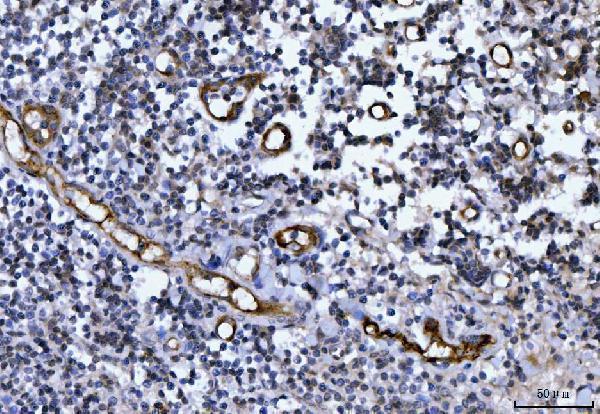  IHC analysis of Von Willebrand Factor/VWF using anti-Von Willebrand Factor/VWF antibody (A00270-1)