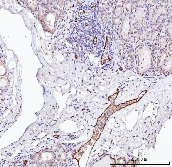  IHC analysis of Von Willebrand Factor/VWF using anti-Von Willebrand Factor/VWF antibody (A00270-1)