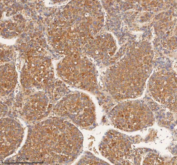  IHC analysis of HEBP1 using anti-HEBP1 antibody (A00271-1)