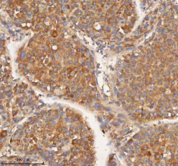  IHC analysis of HEBP1 using anti-HEBP1 antibody (A00271-1)