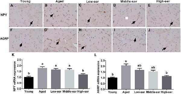 Effects of long-term L -serine administration on orexigenic neuropeptide expression in aging mice