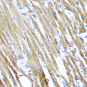 Immunohistochemistry of paraffin-embedded rat heart using SOCS3 antibody