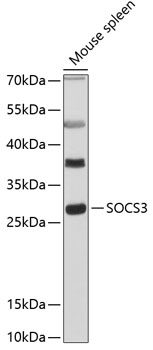 Western blot analysis of extracts of mouse spleen, using SOCS3 antibody