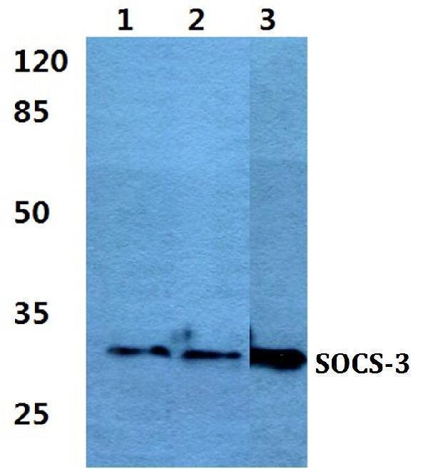 Western blot (WB) analysis of SOCS-3 polyclonal antibody at 1:500 dilution
Lane1:MCF-7 cell lysate
Lane2:Raw264