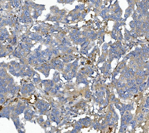 a00275 2 afm primary antibodies ihc testing 2
