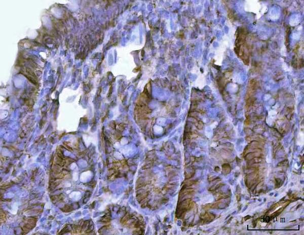  IHC analysis of CD326/Epcam using anti-CD326/Epcam antibody (A00276-2)