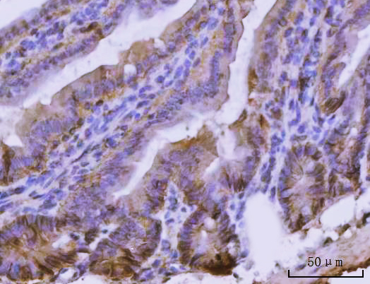  IHC analysis of CD326/Epcam using anti-CD326/Epcam antibody (A00276-2)