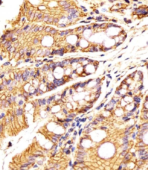 A00276 staining Epcam in Mouse colon tissue sections by Immunohistochemistry (IHC-P -paraformaldehyde-fixed, paraffin-embedded sections). Tissue was fixed with formaldehyde and blocked with 3% BSA for 0. 5 hour at room temperature; antigen retrieval was by heat mediation with a citrate buffer (pH6). Samples were incubated with primary antibody (1/25) for 1 hours at 37°C. A undiluted biotinylated goat polyvalent antibody was used as the secondary antibody.
