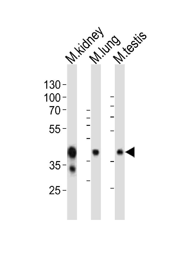 Western blot analysis of lysates from mouse kidney, mouse lung, mouse testis tissue lysate (from left to right), using Epcam Antibody (C-term). A00276 was diluted at 1:1000 at each lane. A goat anti-rabbit IgG H&L (HRP) at 1:10000 dilution was used as the secondary antibody. Lysates at 20ug per lane.